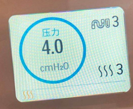 昆明呼吸机，昆明飞利浦呼吸机，飞利浦呼吸机云南代理商